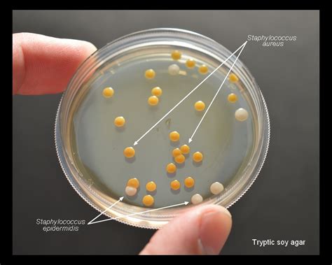 Staphylococcus Epidermidis On Agar Plate With Tryptic Soy Agar