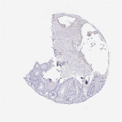 Tissue Expression Of Chga Staining In Stomach The Human Protein Atlas