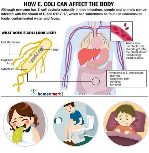 E Coli Symptoms