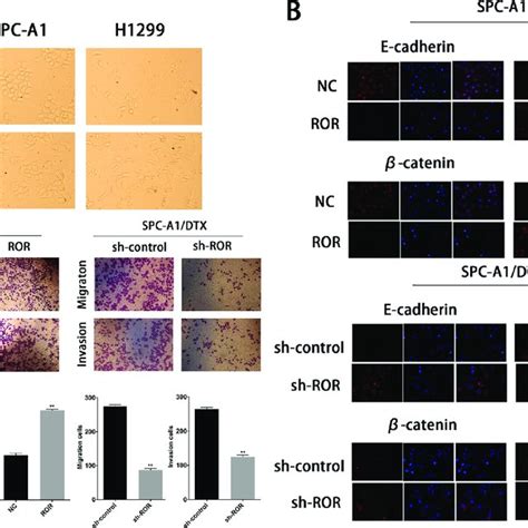 Expression Of Linc ROR Is Associated To The Epithelial Mesenchymal