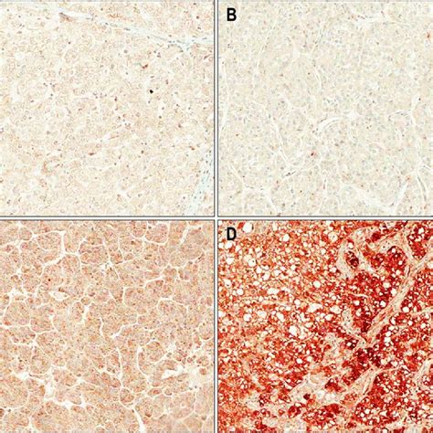 Immunohistochemical Staining Of Periostin Original Magnification