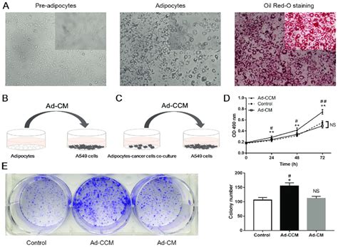 Differentiation Of Mature Adipocytes And The Role Of Adipocyte