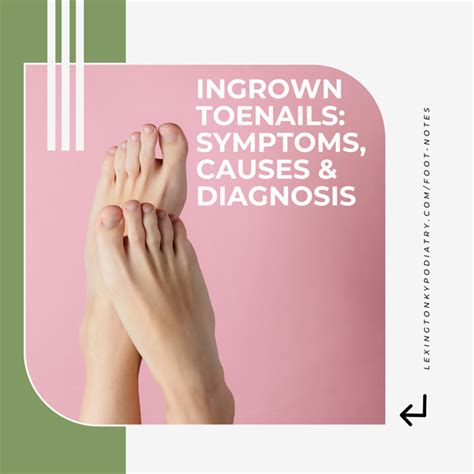 Ingrown Toenails Symptoms Causes And Diagnosis