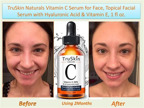 Truskin Naturals Vitamin C Serum Review 2018 Impressive Results Vitamin C Serum Reviews