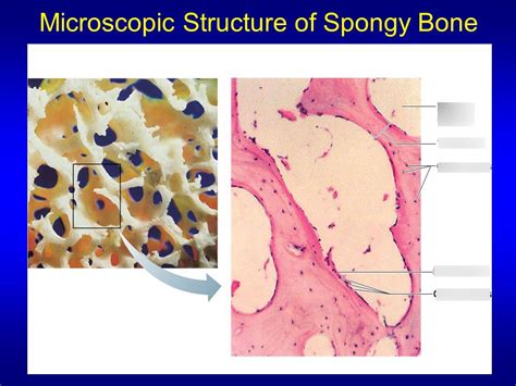 Spongy Bone Under Microscope