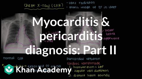 Diagnosis Of Myocarditis And Pericarditis Part Nclex Rn Khan