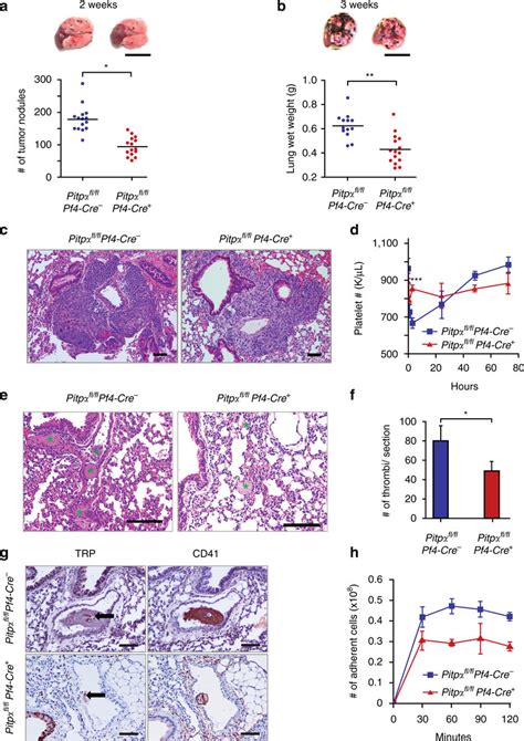 Loss Of Pitp In Platelets Impairs Tumor Metastasis Formation A The