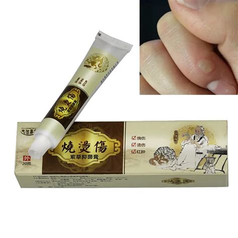 1pcs Hua Tuo Burn Ointment Anti bacteria Burn Scald Scar Removal Cream ...