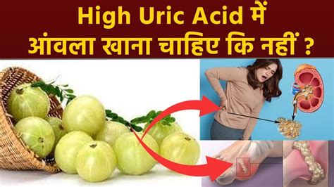 High Uric Acid Me Amla Khana Chahiye Ki Nahi हाई यूरिक एसिड में आंवला खाना चाहिए कि नहीं Youtube