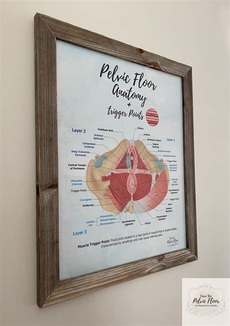 Trigger Points in Pelvic Floor Anatomy Poster Art | Etsy