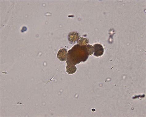 Urine crystals | eClinpath