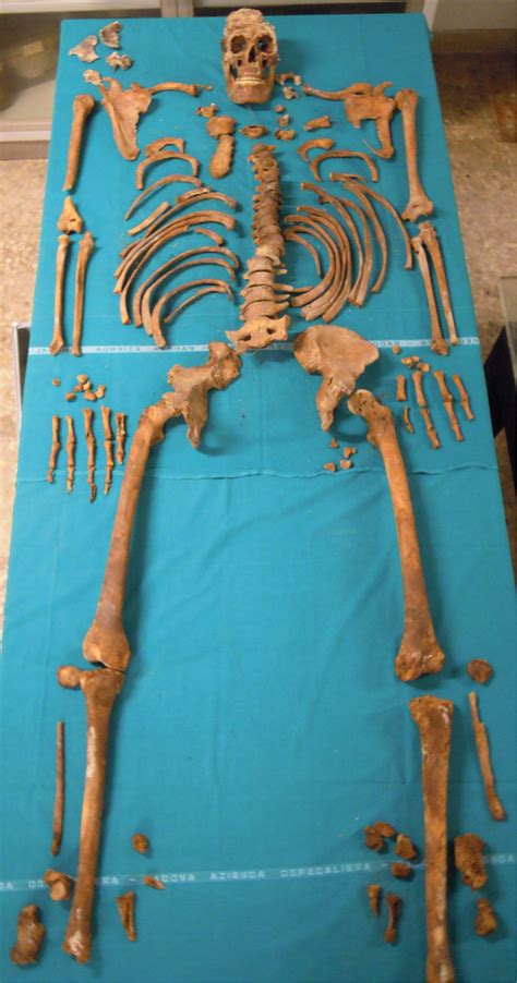 La exhumación del esqueleto de Pacchierotti permite estudiar los