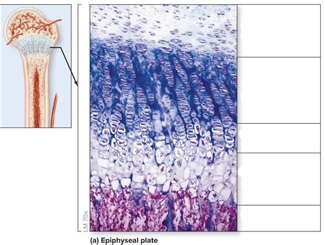 Epiphyseal Plate Zones Test 3 Diagram Quizlet