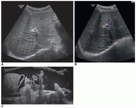 The Pediatric Abdomen Radiology Key