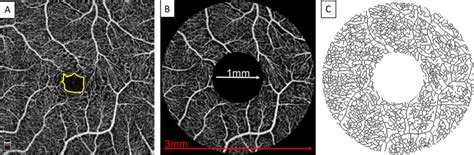 Schematic Of Optical Coherence Tomography Angiography OCTA