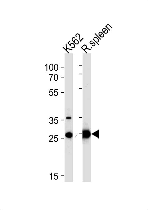 Slc A Antibody C Term Affinity Purified Rabbit Polyclonal