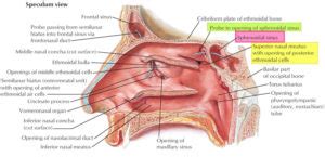 Sphenoid sinus anatomy, function, sphenoid sinus infection & surgery