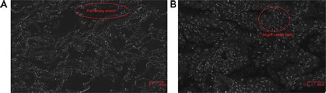 Frontiers Rapid En Bloc Hematoxylin Eosin Staining For Human Lung