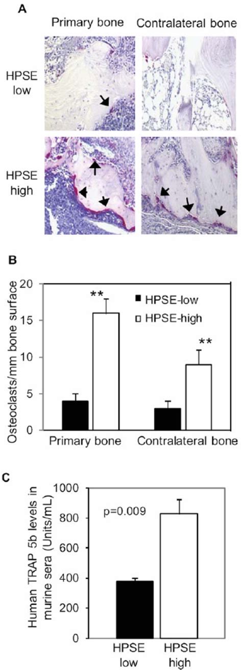 Osteoclastogenesis Is Enhanced In Mice Bearing Hpse High Tumors