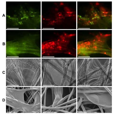 Micrographs Of Human Dermal Fibroblasts Hdfs And Immortalised