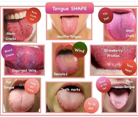 Healthy Tongue Tongue Health Body Health Tcm Traditional Chinese