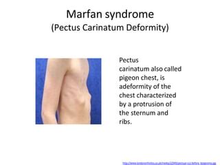 systemic connective tissue diseases pptx