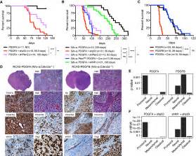 Most Human Non Gcimp Glioblastoma Subtypes Evolve From A Common Proneural Like Precursor Glioma