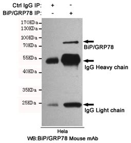 Anti BiP GRP78 Antibody Mouse Anti Human Monoclonal Antibody WB IF