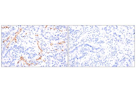 VE Cadherin E6N7A Rabbit MAb Cell Signaling Technology