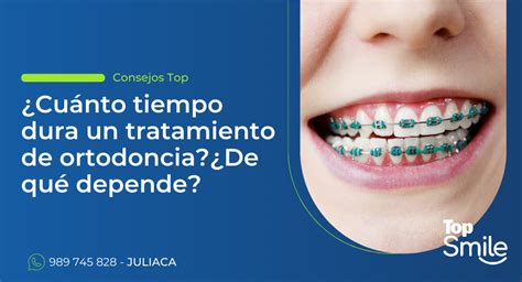 Cuánto tiempo dura un tratamiento de ortodoncia De qué depende