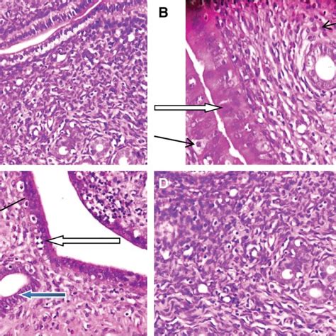 A Control Normal Architecture The Endometrium Epithelial Layer The