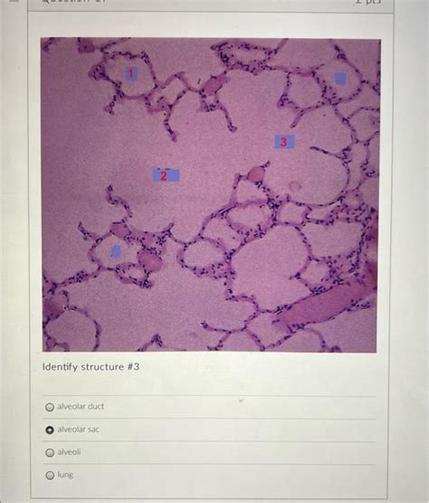 Solved Identify structure \#3 alveolar duct alveolar sac | Chegg.com