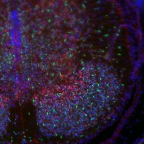 Immunohistochemistry Of Spinal Cord Sections From Myt1 Knock In Mice A Download Scientific