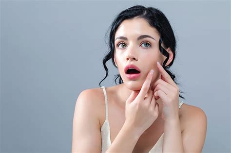 I Dermocosmetici Per Curare Acne E Rosacea I Consigli Giusti In