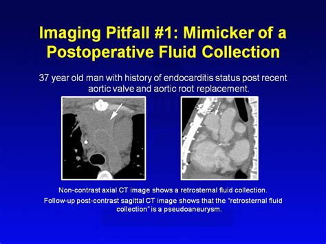 Chest Learning Modules Ct Scanning