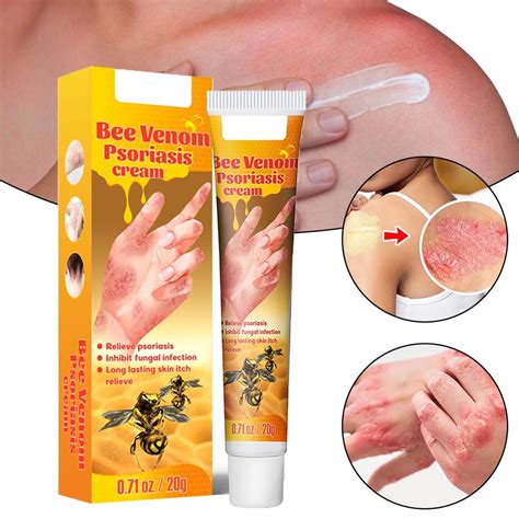 Bees Venom Psoriasis Cream Treatment Soothing Moisturizing Anti Itch