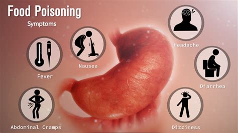 Understanding Food Poisoning Symptoms Causes And Treatment Ask The Nurse Expert