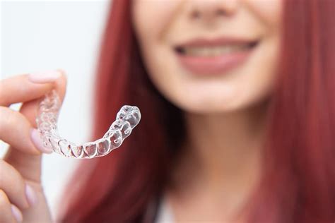 How Long Does Invisalign Take To Straighten Teeth Smile Shack