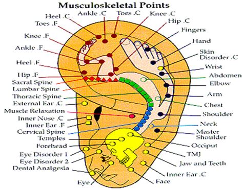 Battlefield Acupuncture Rapid Auriculotherapy Technique For Pain Reduction