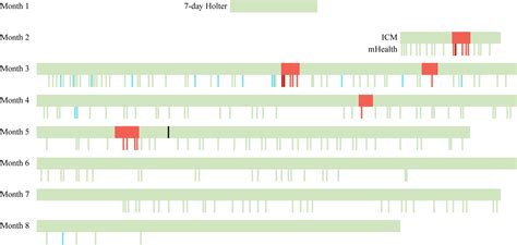 Cryptogenic stroke: FibriCheck versus Insertable Loop Recorder