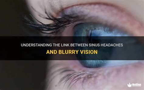 Understanding The Link Between Sinus Headaches And Blurry Vision Medshun