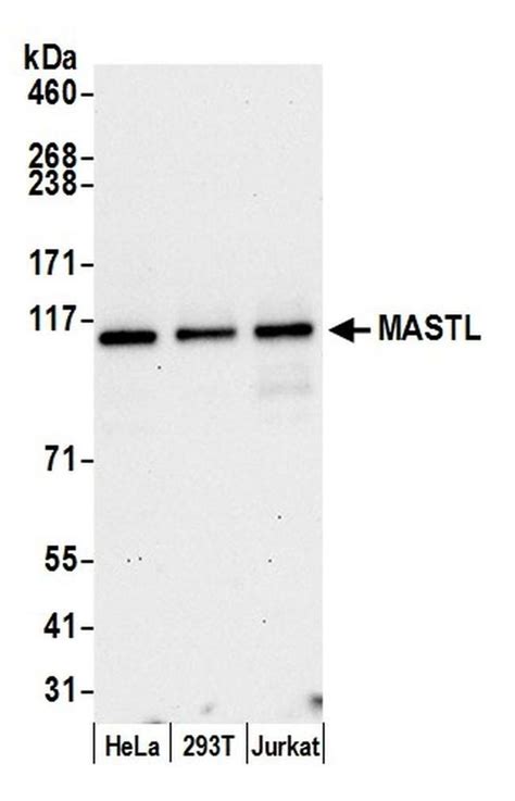 Mastl Polyclonal Antibody A302 190a T