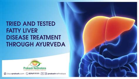 Tried And Tested Fatty Liver Disease Treatment Through Ayurveda Prakash Nethralaya