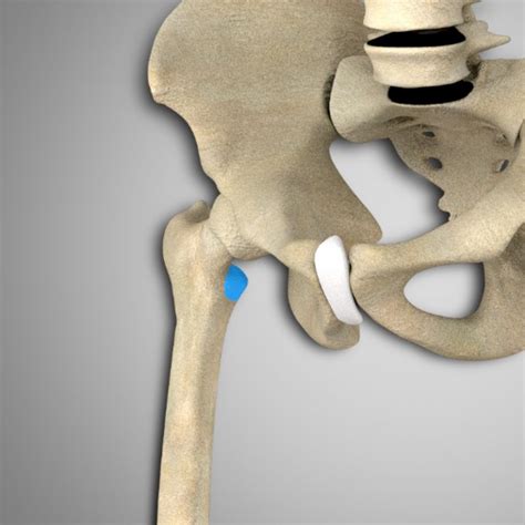 Iliopsoas Attachments And Actions 3D Muscle Lab