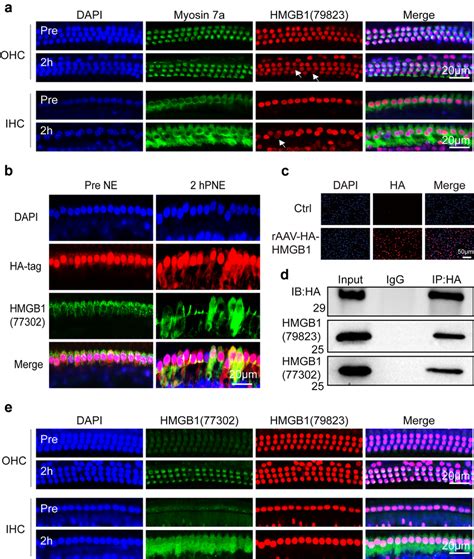 Hmgb1 Cytoplasmic Accumulation Before Cellular Release Occurred Early