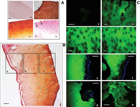 Histological Anatomo Pathological Analysis Of Hematoxylin And Eosin