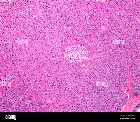 Low Magnification Light Micrograph Of A Human Pancreas Showing An Islet