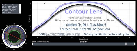 Specialty Contact Lenses In Hk For Astigmatism Keratoconus Post Lasik