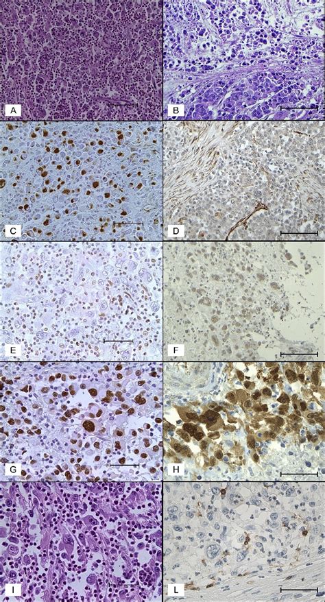 Morphological And Immunohistochemical Features In Crbcs And Pdmcs A Download Scientific