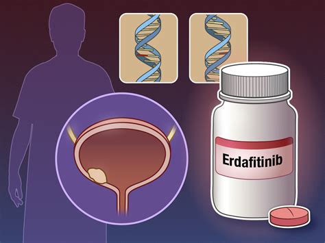 Erdafitinib In Advanced Or Metastatic Urothelial Carcinoma New England Journal Of Medicine